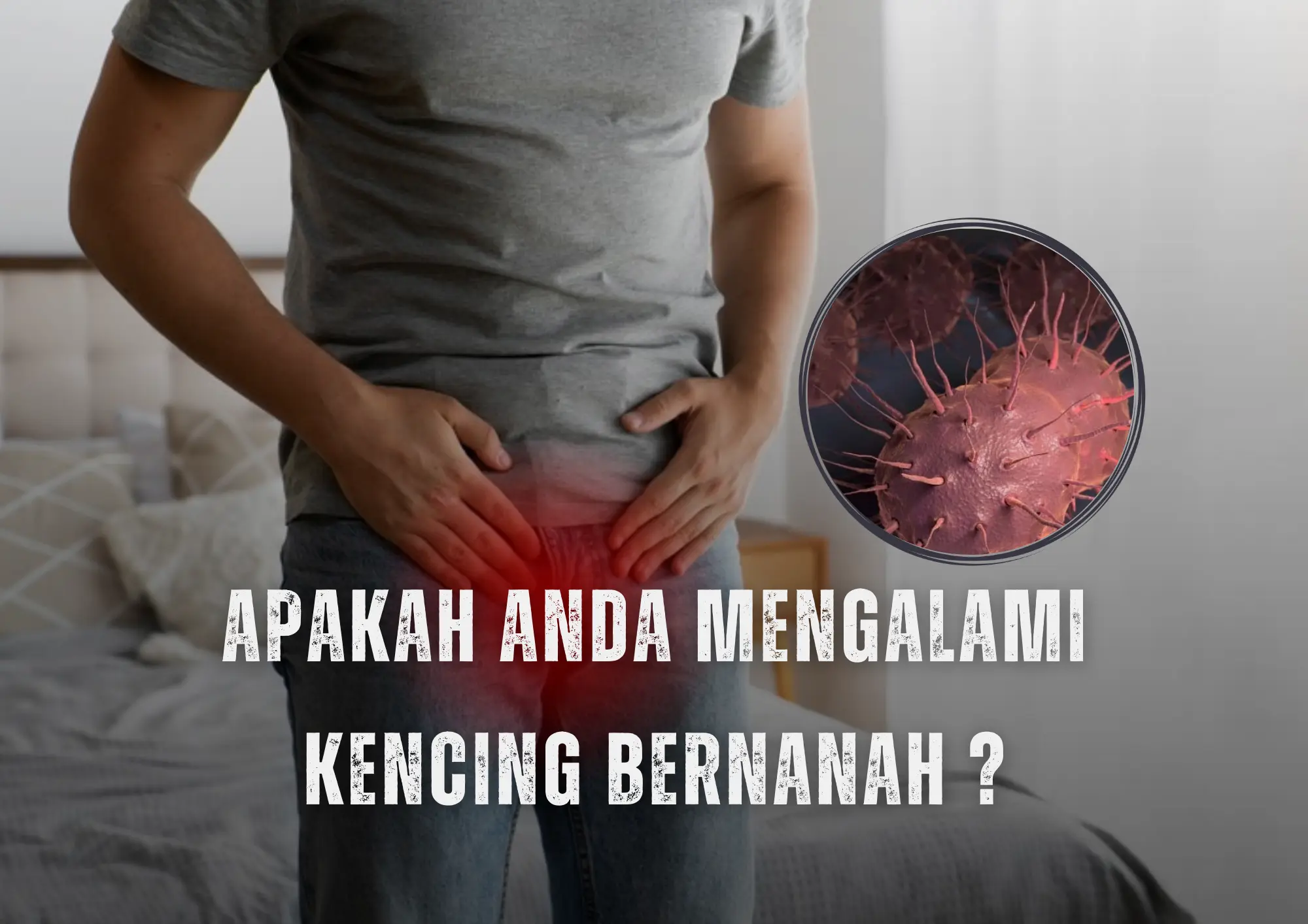 obat kencing nanah ampuh - obat kencing nanah untuk pria - obat gonore - obat penyakit gonore - obat kencing nanah alami (1)