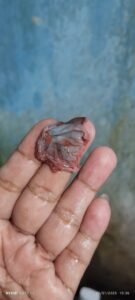 obat batu ginjal obat penghancur batu ginjal obat kencing batu obat batu ginjal ampuh obat peluruh batu ginjal